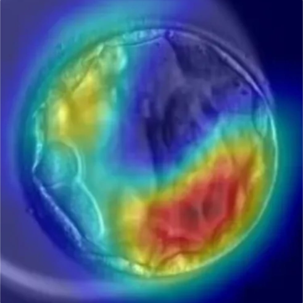 コウノトリ AI Embryo