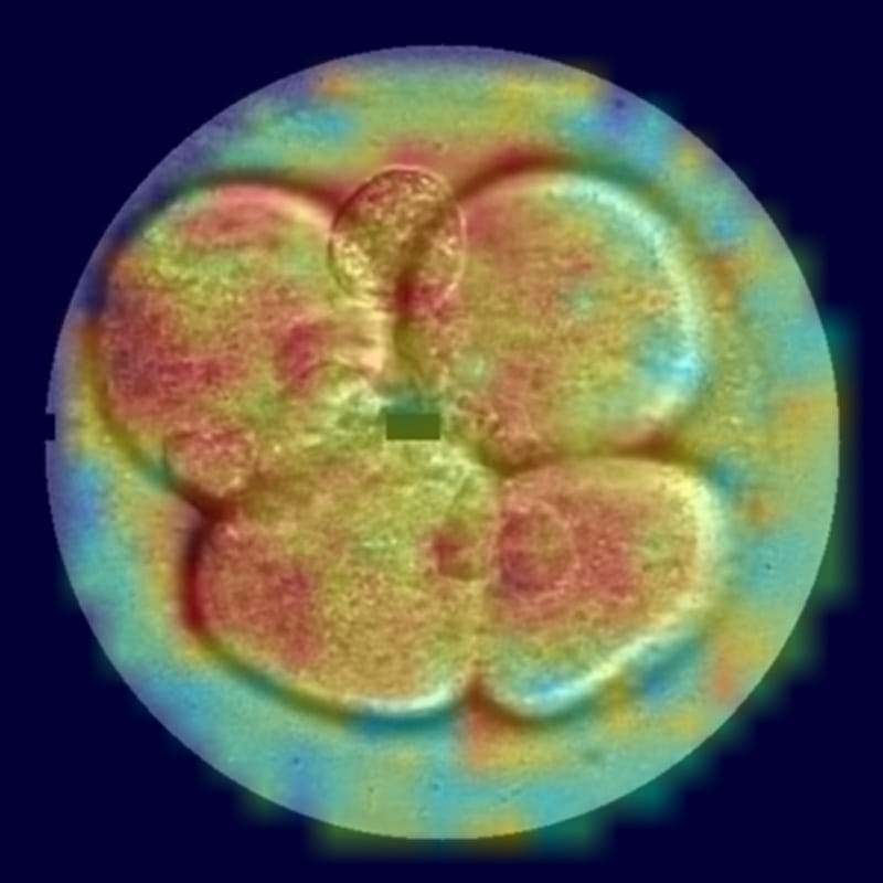 コウノトリ AI Embryo