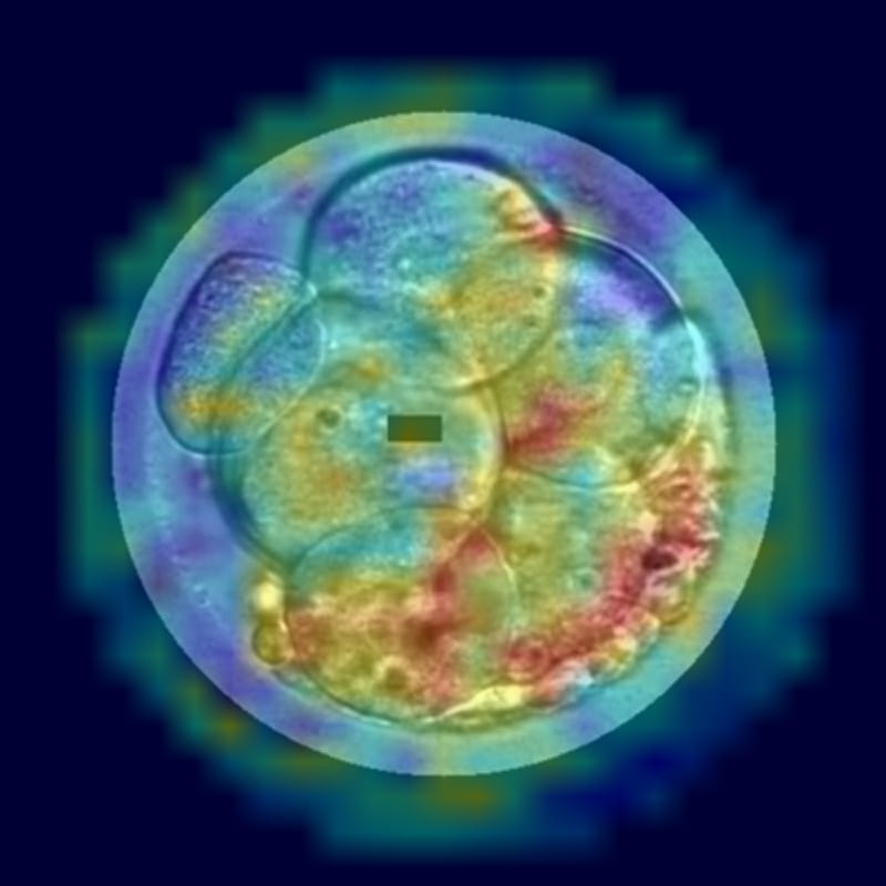 コウノトリ AI Embryo