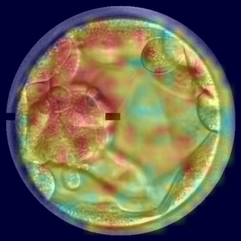 コウノトリ AI Embryo